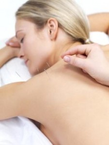 Akupunktur und schwangerschaft